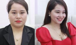 Vừa sinh đôi, mẹ bỉm sữa đã lấy lại gương mặt thon gọn nhờ đúng 1 bí quyết