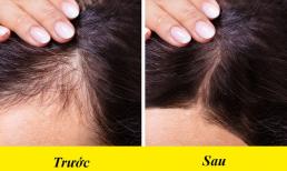 7 biện pháp tự nhiên giúp kích thích mọc và làm dày tóc