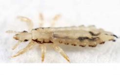 Tại sao ngày xưa người dân thường có chấy rận trên người, còn nay hiếm? Lý do thực sự rất đơn giản!