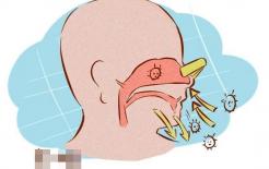 Nam thanh niên nhổ lông mũi, nhưng chết vì nhiễm trùng nội sọ? Lông mũi “thò” ra có phải nhổ không? 