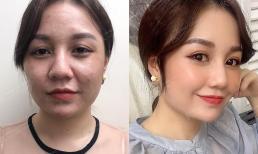 Hé lộ phương pháp trẻ hóa vượt trội trong năm 2021