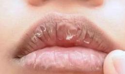 Khô miệng khi ngủ có thể là tín hiệu xấu về sức khỏe, đừng vội bỏ qua 