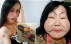Một người chuyển giới ở Brazil tự tiêm silicone công nghiệp gây biến dạng khuôn mặt và bị chế giễu là 'quả bí đao lớn'