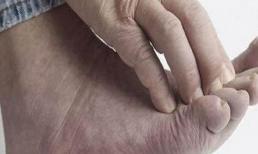 Nếu bốn tình trạng này xảy ra trên bàn chân, đó có thể là dấu hiệu của một căn bệnh nghiêm trọng mà hầu hết mọi người không nhận ra