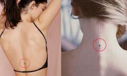 Những vị trí nốt ruồi rất tốt cho tài lộc, đừng dại mà xóa kẻo xui xẻo ập đến