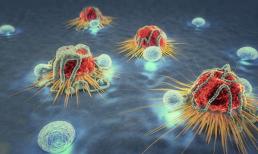 Nếu trên cổ xuất hiện 3 dấu hiệu này, rất có thể tế bào ung thư sắp 'bùng phát', nên cẩn thận!