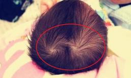 Tại sao số xoáy tóc trên đầu trẻ lại khác nhau? Không phải là tính cách khác biệt, có những lý do khác đằng sau nó 