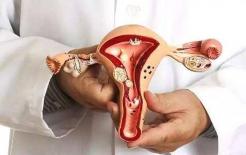 Hai cơn đau này trên cơ thể phụ nữ có thể là “gióng lên hồi chuông báo động” ung thư cổ tử cung, hãy biết và phòng tránh sớm 