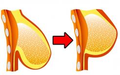 7 tư thế yoga siêu hiệu quả để có bộ ngực đẹp 