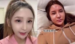 Hot girl nổi tiếng công khai ảnh phẫu thuật hỏng lõm cả trán, khuôn mặt biến dạng