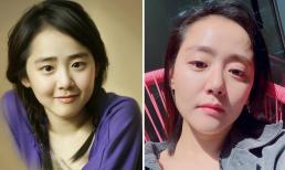 Lâu rồi mới tái xuất, 'em gái quốc dân' Moon Geun Young được khen nhuận sắc nhưng lại bị nghi có dấu hiệu hói đầu