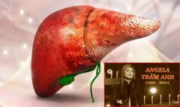 Ca sĩ Angela Trâm Anh qua đời đột ngột ở tuổi 36 vì ung thư gan: Căn bệnh nguy hiểm khiến cả nhân loại khiếp sợ
