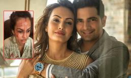 Sao nữ Ấn Độ đệ đơn kiện vì bị chồng đánh đập và ngoại tình