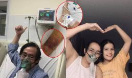 Nghệ sĩ Giang Còi để lộ vết thương ở tay sưng to, lạc quan dù phải đeo máy thở