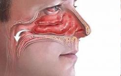 Tỷ lệ mắc ung thư vòm họng cao? Bác sĩ nhắc: Có 5 dấu hiệu, rất mong các bạn tránh được