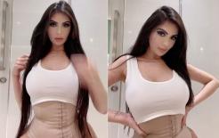 Nữ đại gia Brazil suýt chết sau khi phẫu thuật thẩm mỹ hàng trăm lần, kêu gọi phụ nữ đừng dễ dàng đụng đến dao kéo