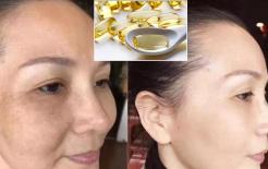 “Vitamin E” thoa lên mặt có tác dụng làm trắng và mờ vết nám, nhưng tại sao bạn dùng lại không hiệu quả? Chỉ bạn phương pháp để hiệu quả