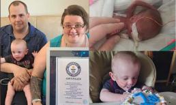 Em bé sinh non nhất thế giới chỉ nặng 337 gam sống sót một cách thần kỳ, đón sinh nhật đầu tiên