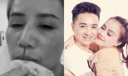 Diễn viên Hoàng Yến lên tiếng sau khi bị chồng cũ hành hung: 'Người tôi đã từng sống, hy sinh tới tận xương tủy'