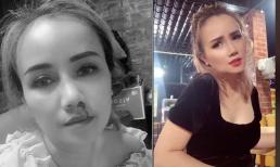 Bị chồng cũ đấm gãy xương mũi nhưng chỉ sau 2 ngày mặt của Đào Hoàng Yến đã lành lặn?