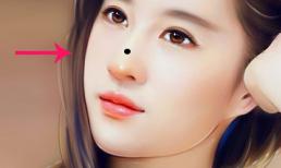 Nốt ruồi xấu trên mặt cản trở đường tài lộc, tình duyên lận đận. Xóa bỏ sớm để không vướng tai họa