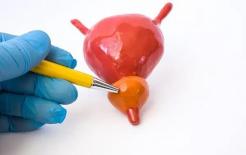 Ung thư tuyến tiền liệt tập trung vào 4 người này, bạn có nằm trong số đó? Làm tốt 3 điều nếu muốn 'được tha'!