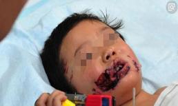 Con trai bị chó cắn, bố mẹ tức giận quyết định giết chú chó, nhưng sau khi tìm thấy chú chó thì tất cả phải chết lặng