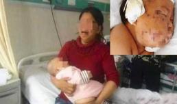 Bạn còn nhớ cậu bé bị mẹ đâm nhiều nhát kéo vào mặt vì 'cắn ti' khi đang bú không? Tình trạng hiện tại thật đáng ngạc nhiên