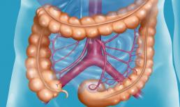 Đây là cách phát hiện ung thư ruột chính xác nhất, không có biện pháp thay thế! Nên kiểm tra trước 40 tuổi