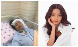  Sau ca mổ u màng não, hình ảnh người mẫu chuyển giới Chau Kim Sang trên giường bệnh lần đầu được chia sẻ