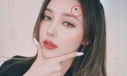 5 nốt ruồi tụ tài bậc nhất, ai sở hữu thì giàu sang tột đỉnh, vinh hoa phú quý sau tuổi trung niên