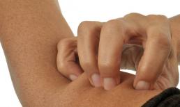 Nếu trên cơ thể có 2 vết 'ngứa', rất tiếc phải thông báo với bạn: đường huyết quá cao, hãy quan tâm kịp thời