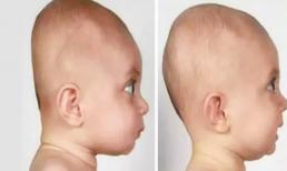 Ba tư thế ngủ này của trẻ sẽ khiến hộp sọ phát triển và biến dạng, đến khi biết thì đã quá muộn