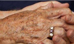 Không phân biệt nam nữ, ở độ tuổi nào bạn bắt đầu xuất hiện các đốm đồi mồi? Làm tốt 3 việc, không thì về già khó tránh đốm da