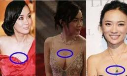 Trên cơ thể có năm “nốt ruồi vượng phu ích tử”, có tác dụng hút tài lộc, thêm phú quý, bạn đã có chưa?