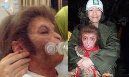 Bị mẹ ruột bỏ rơi vì xấu xí từ lúc 5 tuổi, cậu được Châu Tinh Trì phát hiện, giờ nhìn ngoại hình lúc 19 tuổi ai cũng thấy mừng cho cậu 