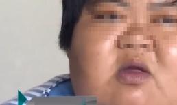 Người phụ nữ hơn 150kg ăn rau mỗi ngày để giảm cân, ai ngờ cân nặng còn tăng lên thêm, bác sĩ: giảm cân nên hợp lý 