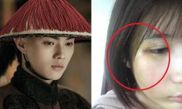 Bạn gái cũ 'Phó Hằng' Hứa Khải vừa lật lại scandal bạo hành năm xưa thì đã có cú 'quay xe' bất ngờ