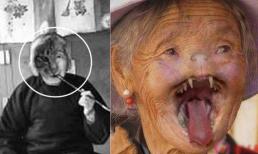 Sự thật về những bức ảnh bà già mặt mèo năm 1995