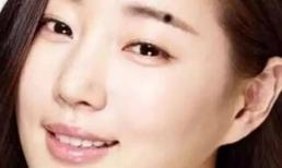 Bạn có 4 nốt ruồi phú quý nhất trên người không? 