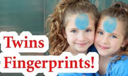 Các cặp sinh đôi giống hệt nhau thì dấu vân tay có giống nhau? 
