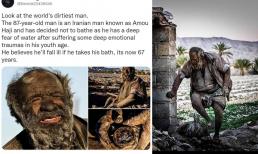 Ông ấy đã phá kỷ lục Guinness! 'Tôi đã không tắm trong 67 năm', và lý do khiến người khác phải rớt nước mắt