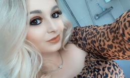 Hoa hậu 22 tuổi người Anh phát hiện bị u não sau cơn đau đầu dữ dội