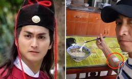 'Triển Chiêu' Hà Gia Kính đi ăn đồ bình dân dù sở hữu tài sản hàng trăm tỷ, gây lo lắng khi lộ miếng băng trắng trên tay