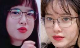 Hết lộ bụng to như mang bầu, 'nàng Cỏ' Goo Hye Sun lại bị soi béo sưng mặt khác xa so với ảnh đăng mạng