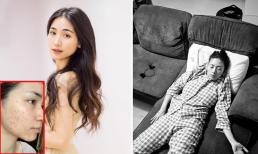 Sao Việt 2/9: Hòa Minzy công khai gương mặt đầy mụn thịt; Ngô Thanh Vân bị tình trẻ chụp lén khi đang ngủ?