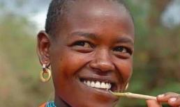 Người Châu Phi ít dùng kem đánh răng, tại sao răng họ vẫn trắng? Nó không chỉ liên quan đến 'màu da đen'