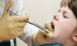 Nên làm gì nếu con mắc chứng sợ nha sĩ?