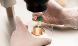 Tại sao ngày càng nhiều người hiến tinh trùng, có lợi ích gì không?