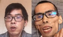 Ung thư trực tràng khủng khiếp như thế nào? Mắc ung thư gần một năm, gương mặt streamer nổi tiếng như biến dạng, quá đáng sợ!